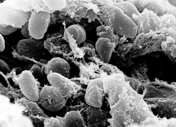 yersinia_pestis